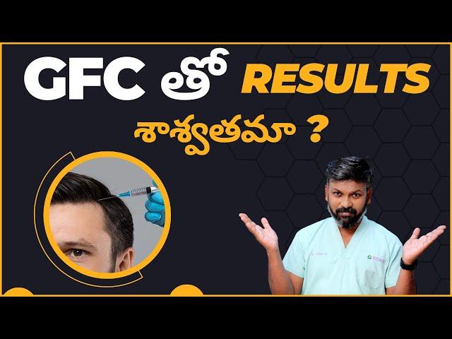 #AskDrJohnWatts | GFC తో RESULTS శాశ్వతమా ? | Best Hair Specialist  Explains