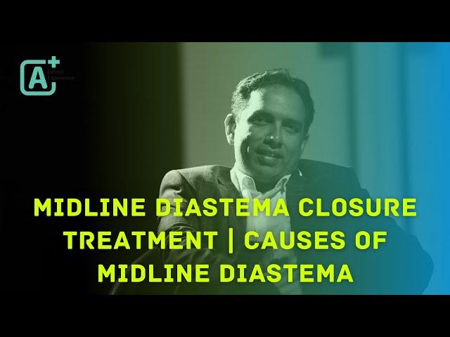 MIDLINE DIASTEMA CLOSURE TREATMENT | CAUSES OF MIDLINE DIASTEMA | By Dr Seby Varghese