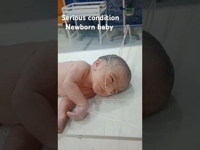  NICU Premature Babies: Understanding Preterm Birth, Challenges & Hope #viralvideo  #shorts