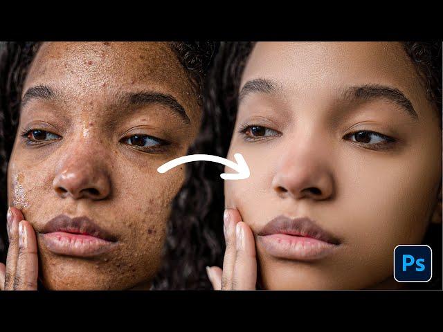 Skin Retouching - Best Photoshop Tutorial | Face Retouching