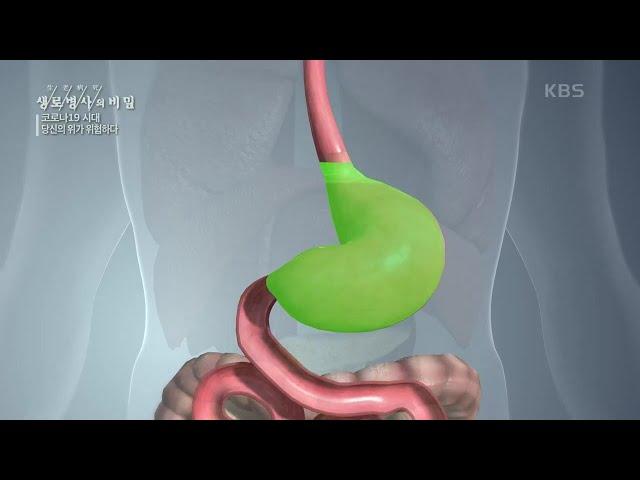 오랜 통증과 소화불량의 원인 [생로병사의 비밀] | KBS 201111 방송