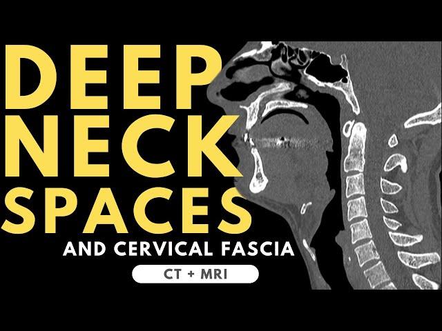 Deep neck spaces and deep cervical fascia anatomy | Radiology anatomy part 1 prep | CT and MRI