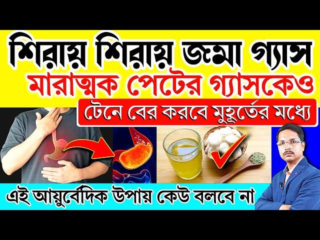 পেটের গ্যাস ও শিরায় জমে থাকা Gas কে টেনে বের করবে মূহূর্তের মধ্যে | গ্যাস থেকে মুক্তির সহজ উপায় |