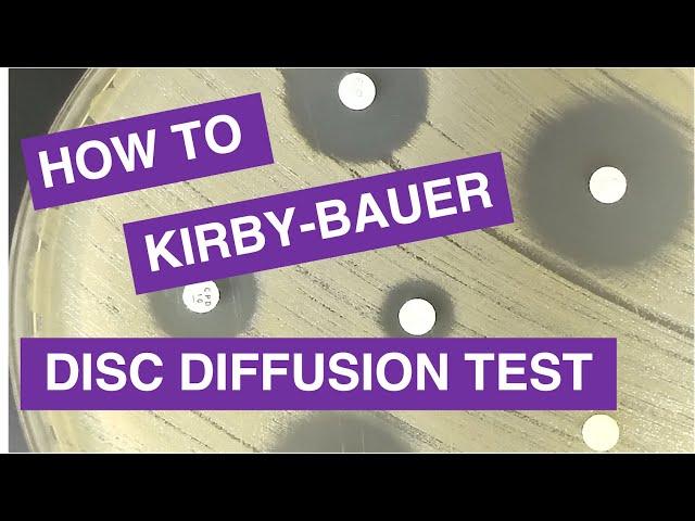 Disc Diffusion (Kirby-Bauer) Antimicrobial Susceptibility Testing