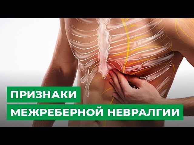 Признаки межреберной невралгии