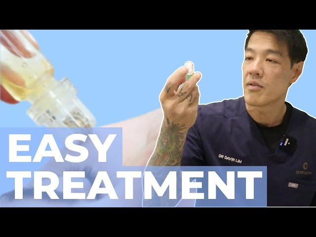 Why you should use Microinfusion skincare | Dr Davin Lim