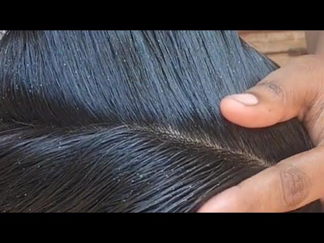 oil hair heavy lice removal long hair with real sound most request