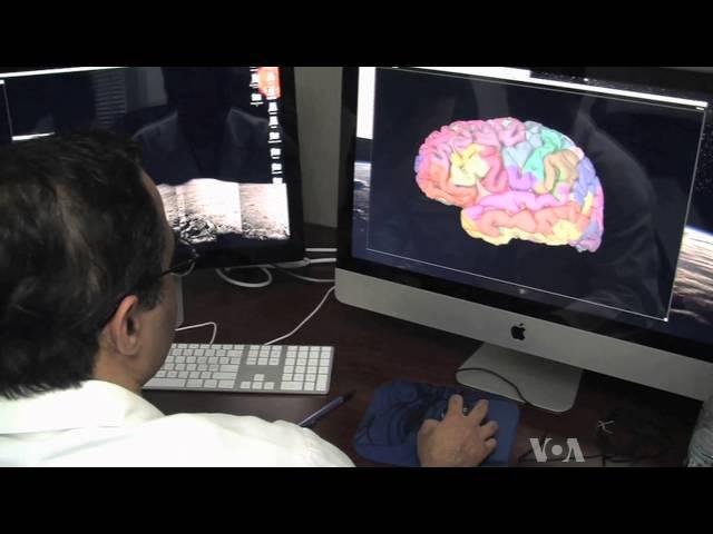 Brain Researchers Uncover Secrets of Memory