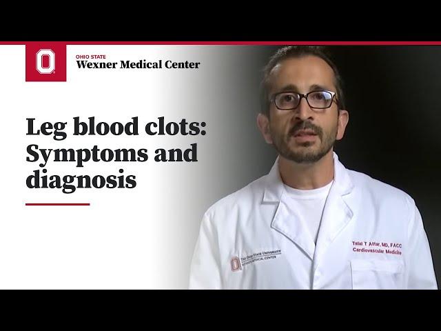 Leg blood clots: Symptoms and diagnosis | Ohio State Medical Center