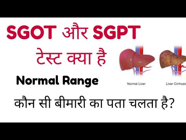 SGOT Blood Test  | SGPT Blood Test | ALT | AST | SGOT & SGPT Test Normal Range@MLTLabManual2.0