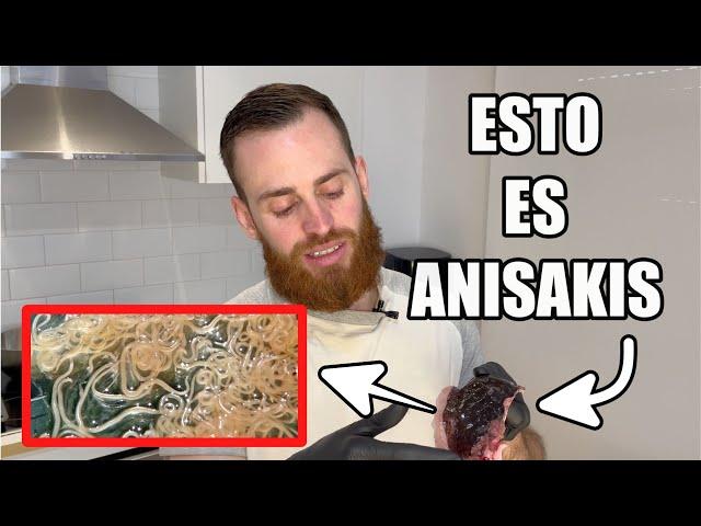 Anisakis: Como Identificarlo Y Preparar El Pescado Para No Cogerlo