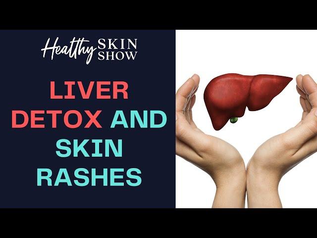 Liver DETOX - Skin Rash Connection, Part 1 | Jennifer Fugo