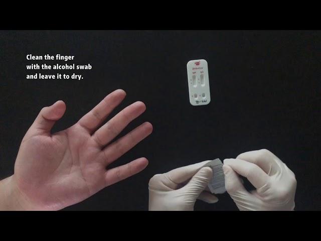 SARS CoV 2 Antibody IgM IgG Test Instructions