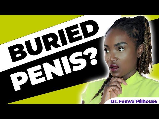 CANT SEE YOUR PENIS? (BURIED PENIS) | Dr. Milhouse