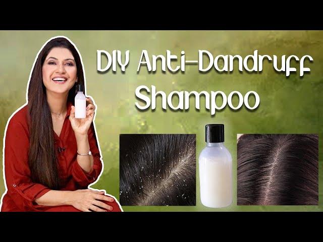 DIY Anti-Dandruff Shampoo For Winter - Ghazal Siddique