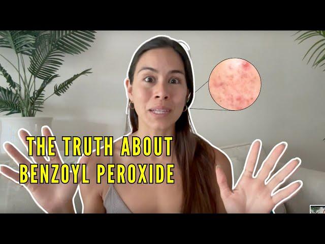 Can you clear your ACNE with Benzoyl Peroxide? (THIS WILL SHOCK YOU)