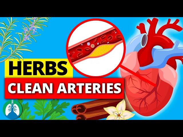 Top 10 Herbs to Clean Your Arteries that Can Prevent a Heart Attack