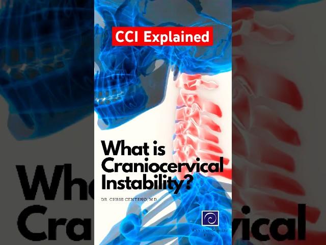 What is CCI? - Dr Centeno Answers Ep.1