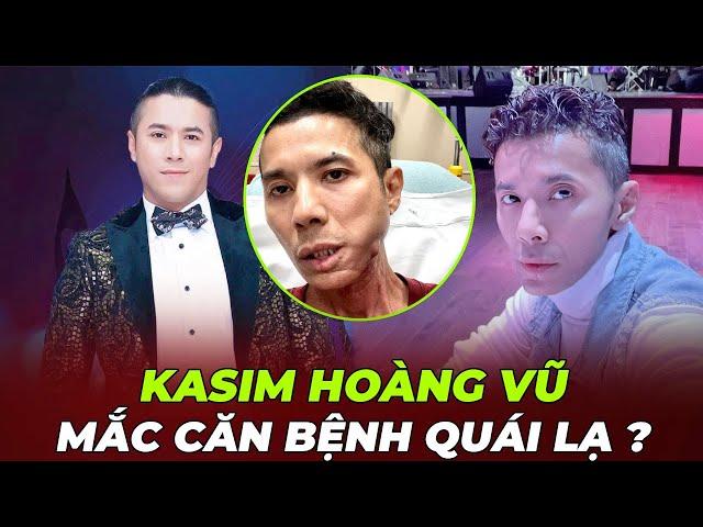 KASIM HOÀNG VŨ MẮC CĂN BỆNH QUÁI LẠ , KHUÔN MẶT BIẾN DẠNG CÓ NGUY HIỂM ĐẾN TÍNH MẠNG HAY KHÔNG ?