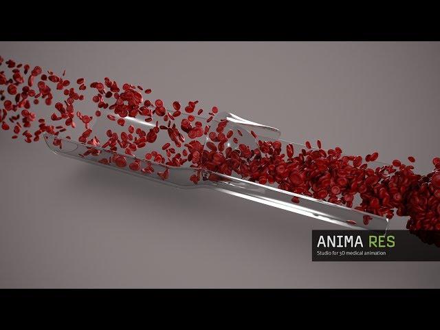 3d animated blood flow - particle simulation