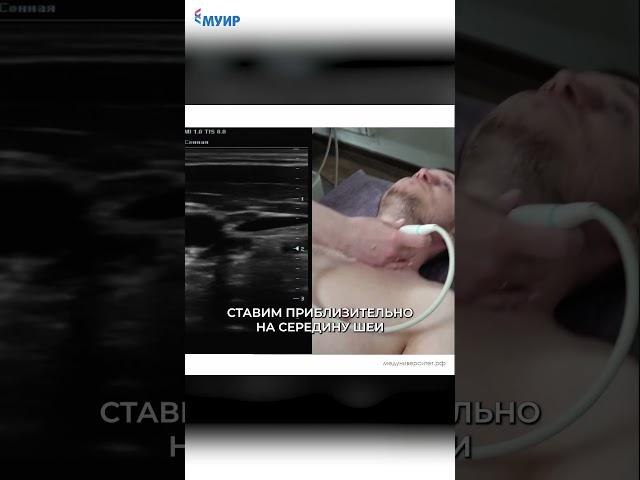 УЗИ сосудов - это сложно? #узи #врач #медицина #обучение #доктор #здоровье #поликлинника #лечение