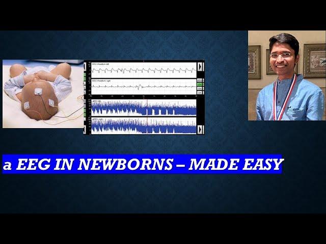 aEEG in Newborns - Made easy