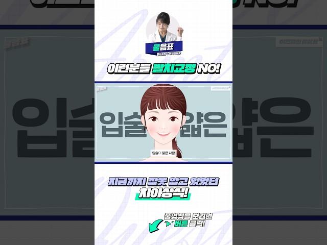 이런분들 발치교정 하지 마세요!! #얇은입술 #입술얇은사람 #치아교정 #발치교정 #치아교정부작용 #치아교정과정