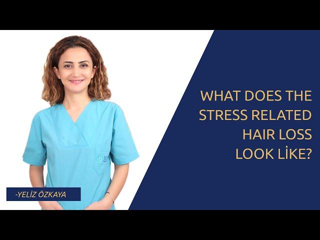 What Does The Stress Related Hair Loss look Like?