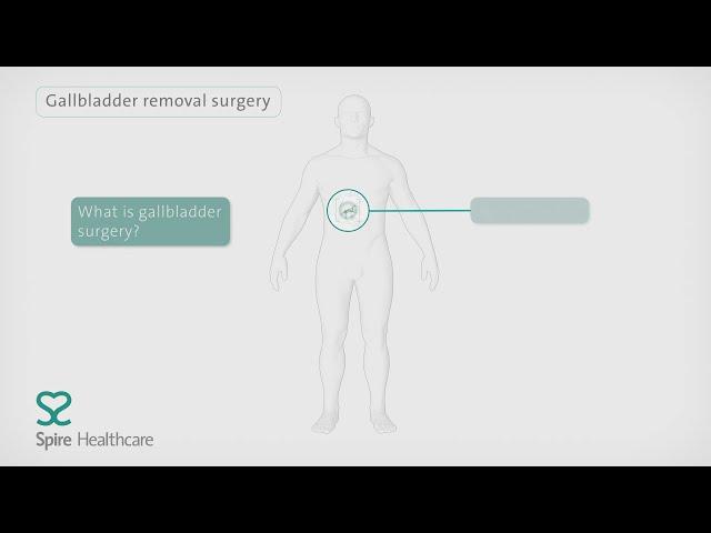 Keyhole surgery for gallbladder removal | Spire Healthcare