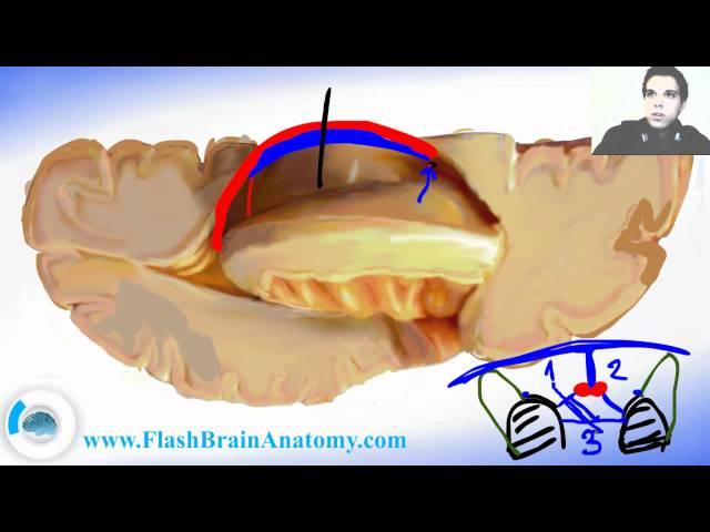 Lessons And 3D Anatomy Software: Ventricular System 2