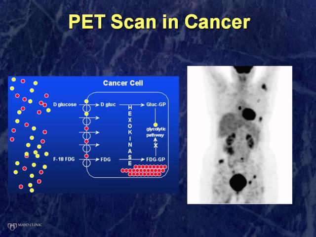 Molecular Imaging of Cancer for the Lay Person