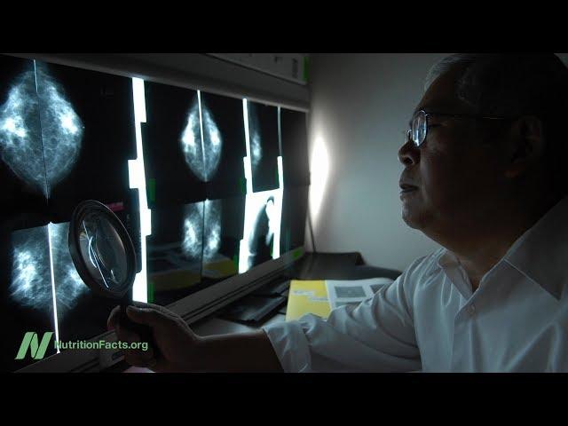 Do Mammograms Save Lives?