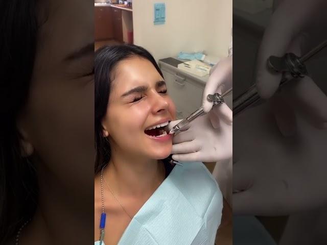 Numb Numb Time ! Share your #numb or #injection experience ! #dentist #dentalhumor #teethchallenge