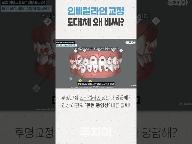 인비절라인 투명 치아교정 치료 비용은 왜 비쌀까? (치과의사 주치아)
