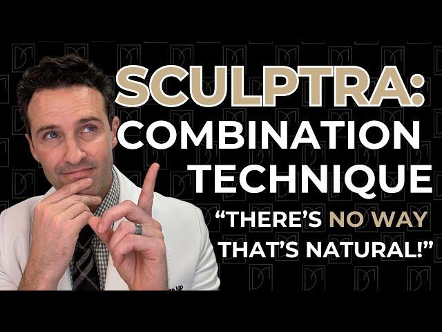 Sculptra: Combination Technique