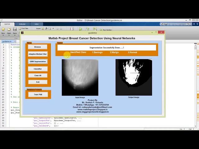 Breast Cancer Detection Using Neural Networks Matlab Project with Source Code