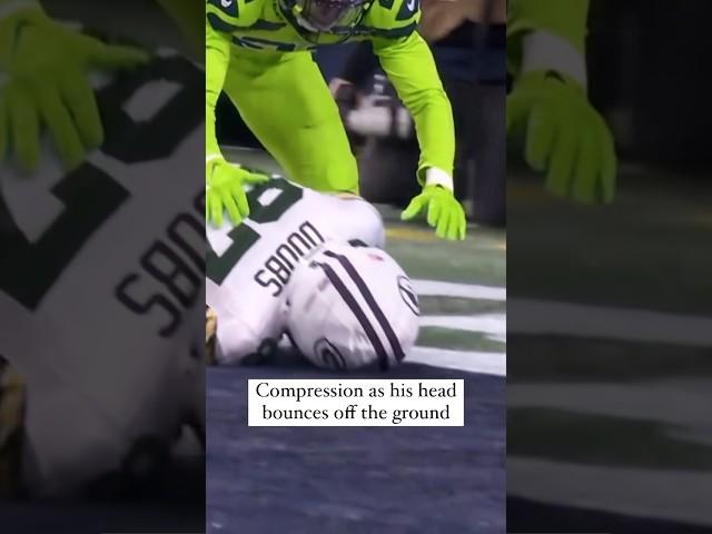 This Guardian cap saved him from a concussion! #shorts #nfl #packers