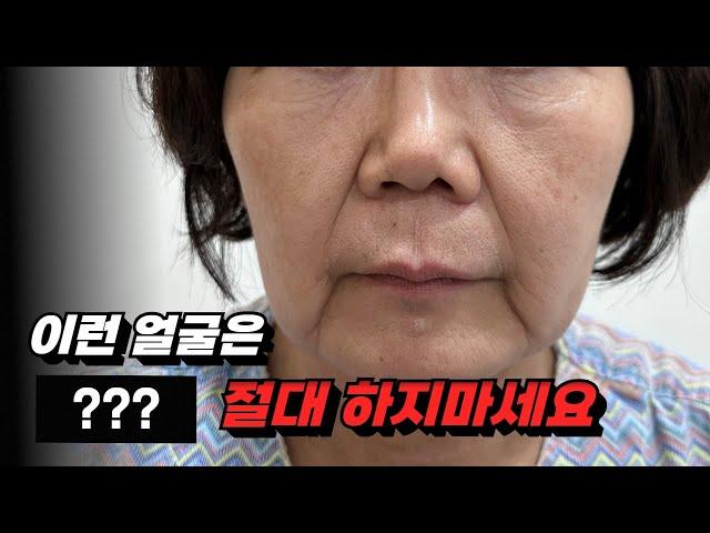 나에게 꼭 필요한 시술 수술만 받는법 | 상담실장들 말에 휘둘리지 않는 법 | 안티에이징 3단계 feat. 지방분해, 지방흡입, 리프팅, 필러, 지빙이식, 스컬트라