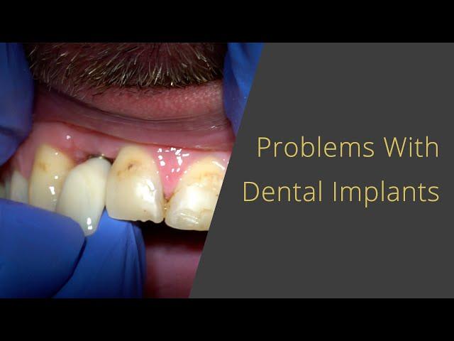 Dental Implant Problems