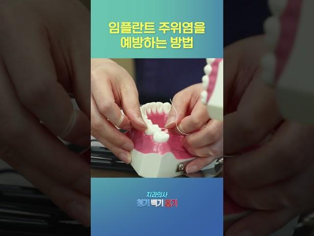 임플란트 관리방법 알려드립니다! 임플란트 주위염 예방하고 오래 쓰는 법