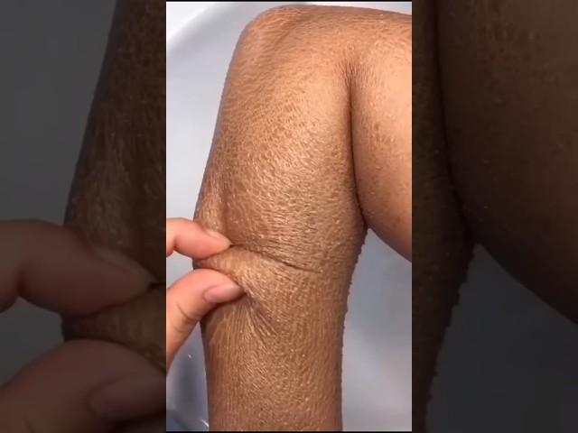 No More Dry Skin Naturally  | Best Home Remedy  #shorts #skincare