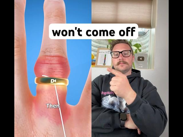 How to Get a Stuck Ring Off With Floss