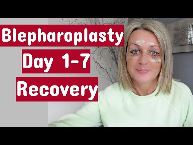 My Eye Surgery (Upper&Lower blepharoplasty) / Day 1-7 Recovery