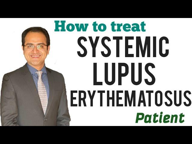 Systemic Lupus Erythematosus (SLE) Treatment, Pathophysiology, Symptoms, Medicine Lecture, USMLE