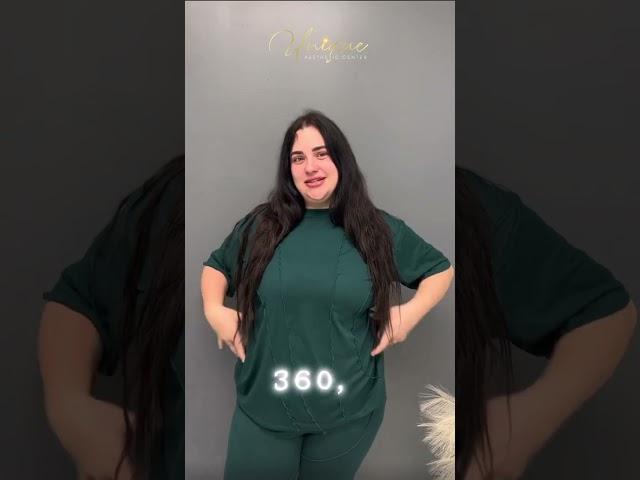 Pre-op patient: Arm Lipo + Lipo 360 + Brazilian Butt Lift with Dr Fisher | Unique Aesthetic Center