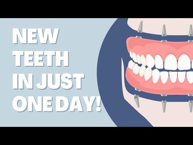 Teeth in a Day Procedure