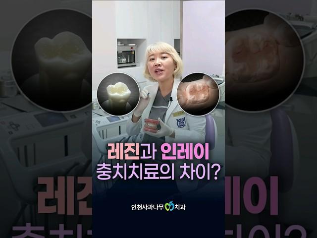레진과 인레이 충치치료의 차이