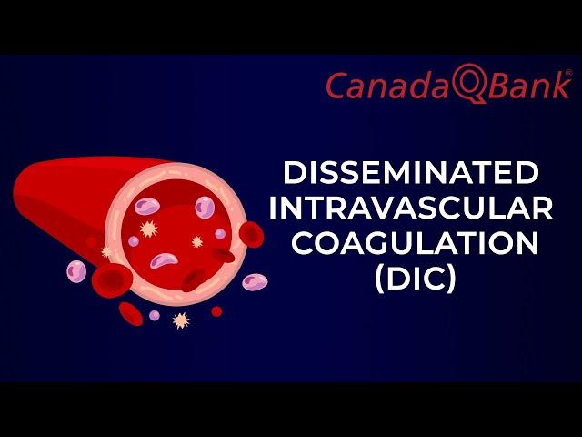 DIC (Disseminated intravascular coagulation)