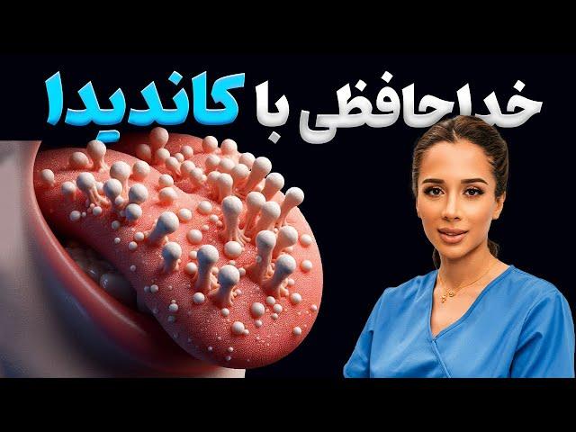 چرا زبانت سفید هست؟| علت کاندیدا در دهان  |دکتر رضایی