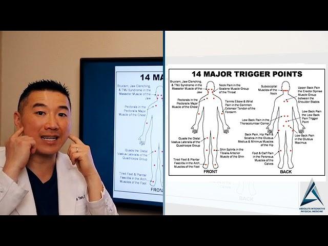 What is Trigger points? Understanding Trigger Point Injections as a Treatment Option.